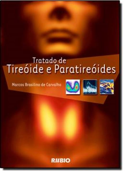 Picture of TRATADO DE TIREOIDE E PARATIREOIDES