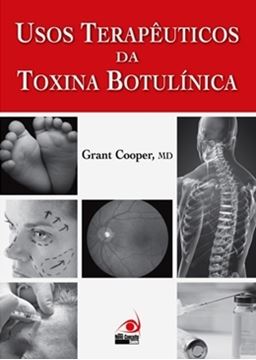 Imagem de USOS TERAPEUTICOS DA TOXINA BOTULINICA