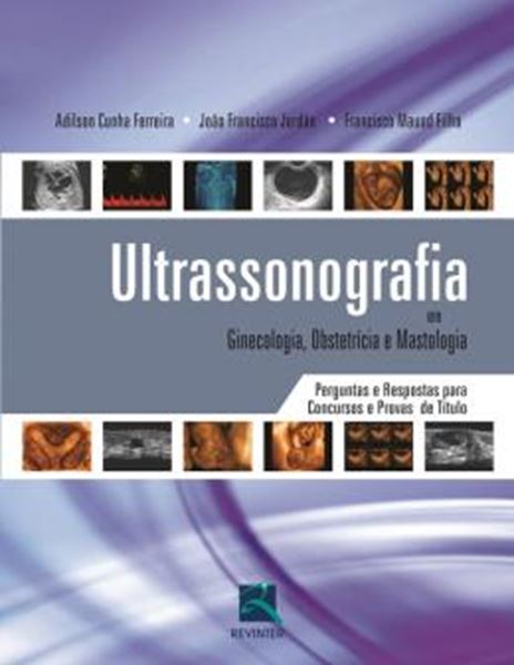 Picture of ULTRASSONOGRAFIA EM GINECOLOGIA, OBSTETRICIA E MASTOLOGIA