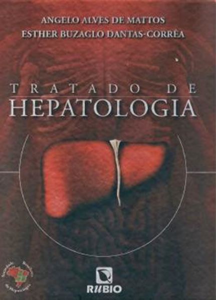 Picture of TRATADO DE HEPATOLOGIA 