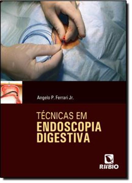 Picture of TECNICAS EM ENDOSCOPIA DIGESTIVA