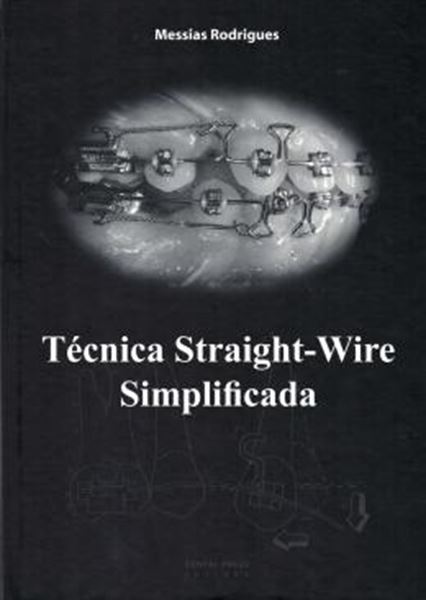 Picture of TECNICA STRAIGHT-WIRE SIMPLIFICADA VERSAO EM ESPANHOL