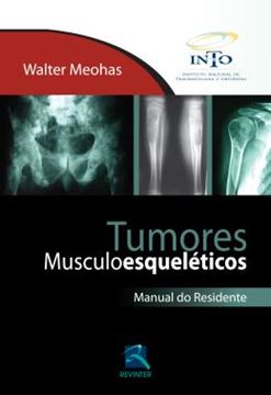 Imagem de TUMORES MUSCULOESQUELETICOS - MAN. DO RESID.