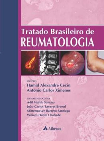 Picture of TRATADO BRASILEIRO DE REUMATOLOGIA