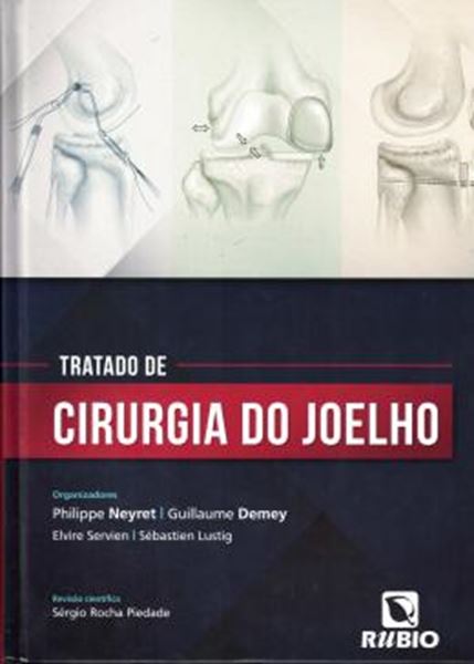 Picture of TRATADO DE CIRURGIA DO JOELHO