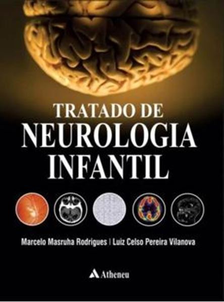 Picture of TRATADO DE NEUROLOGIA INFANTIL