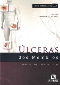 Imagem de ULCERAS DOS MEMBROS - DIAGNOSTICOS E TERAPEUTICAS - 2ª ED