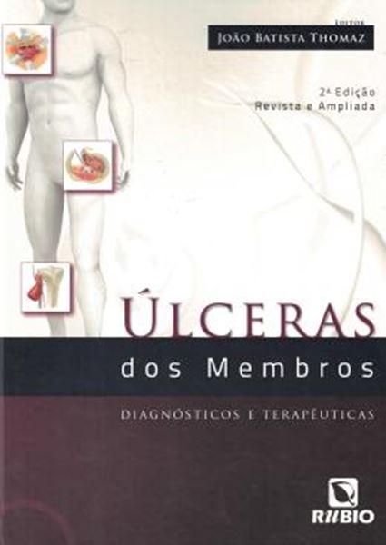 Picture of ULCERAS DOS MEMBROS - DIAGNOSTICOS E TERAPEUTICAS - 2ª ED