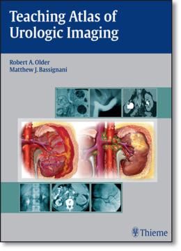 Imagem de TEACHING ATLAS OF UROLOGIC IMAGING