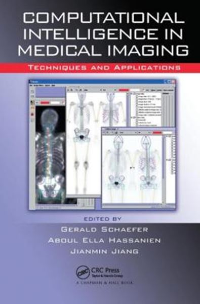 Picture of COMPUTATIONAL INTELLIGENCE IN MEDICAL IMAGING - TECHNIQUES AND APPLICATIONS