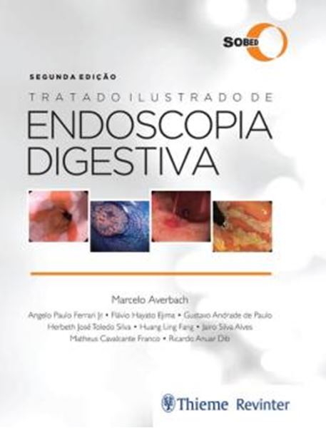 Picture of TRATADO ILUSTRADO DE ENDOSCOPIA DIGESTIVA