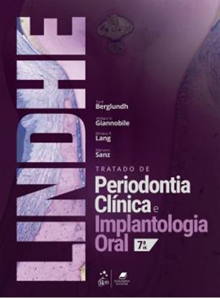 Picture of TRATADO DE PERIODONTIA CLINICA E IMPLANTOLOGIA ORAL - 7ª ED