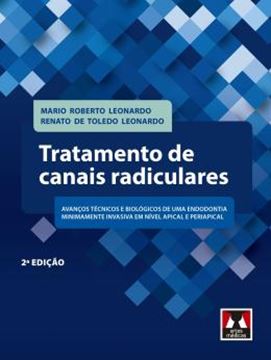 Imagem de TRATAMENTO DE CANAIS RADICULARES - 2ª ED