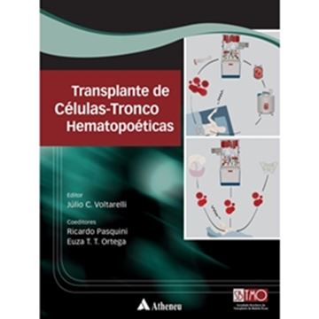 Imagem de TRANSPLANTE DE CELULAS-TRONCO HEMATOPOETICAS