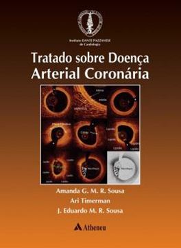 Imagem de TRATADO SOBRE DOENCA ARTERIAL CORONARIA