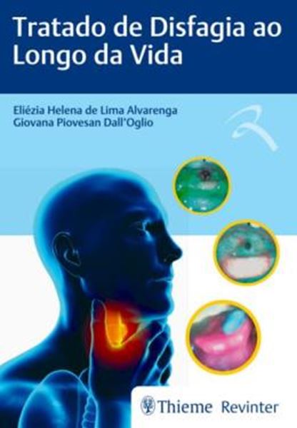 Picture of TRATADO DE DISFAGIA AO LONGO DA VIDA
